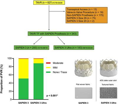 Minimizing Paravalvular Regurgitation With the Novel SAPIEN 3 Ultra TAVR Prosthesis: A Real-World Comparison Study